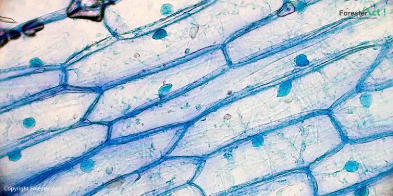 Gambar Sel Tumbuhan Bawang menggunakan Mikroskop